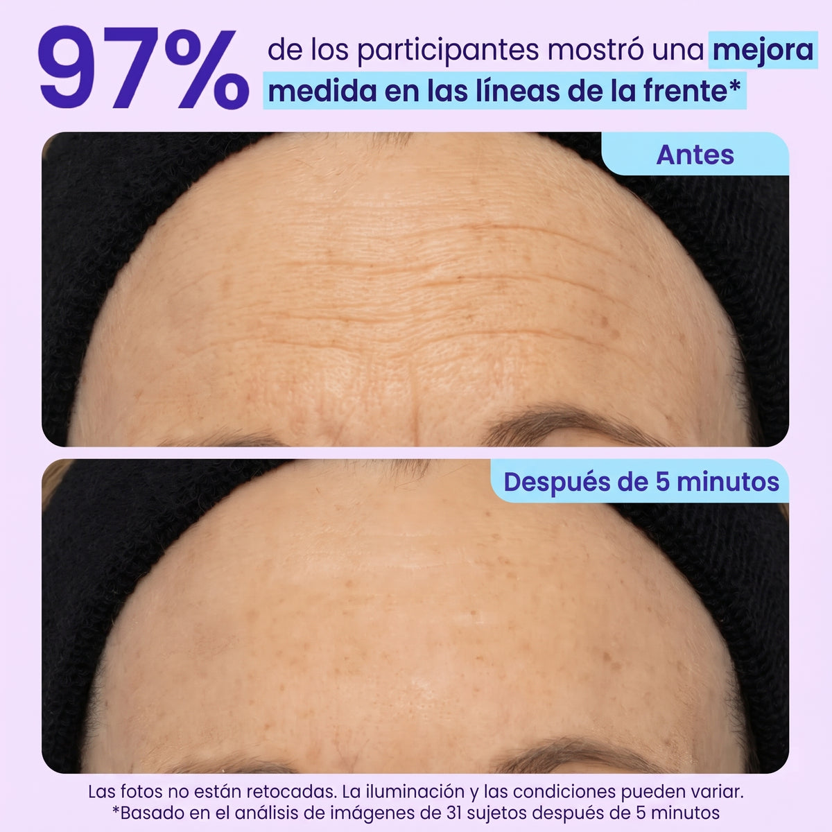 Gel Lifting Instantáneo Para Ojos
