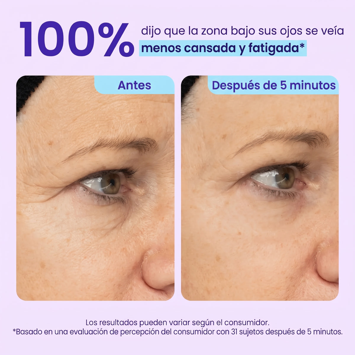 Gel Lifting Instantáneo Para Ojos